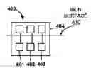 Fig. 01 - Redox Polymer Based Reference Electrodes Having An Extended Lifetime For Use In Long Term Amperometric Sensors