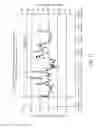 Fig. 12 - Redox Polymer Based Reference Electrodes Having An Extended Lifetime For Use In Long Term Amperometric Sensors