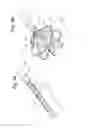 Fig. 04 - Cardiac mapping catheter