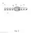 Fig. 04 - MEANS FOR SECURING A CATHETER INTO A VESSEL
