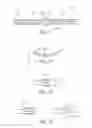 Fig. 06 - MEANS FOR SECURING A CATHETER INTO A VESSEL