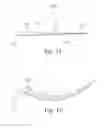 Fig. 08 - MEANS FOR SECURING A CATHETER INTO A VESSEL