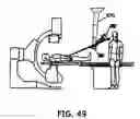 Fig. 55 - Remotely controlled catheter insertion system