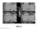 Fig. 08 - Systems and methods for shortened look locker inversion recovery (Sh-MOLLI) cardiac gated mapping of T1