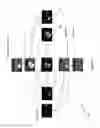 Fig. 05 - Method of Analysis for Dynamic Magnetic Resonance Perfusion Imaging