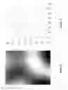 Fig. 08 - Method of Analysis for Dynamic Magnetic Resonance Perfusion Imaging
