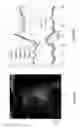 Fig. 10 - Method of Analysis for Dynamic Magnetic Resonance Perfusion Imaging