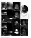 Fig. 11 - Method of Analysis for Dynamic Magnetic Resonance Perfusion Imaging