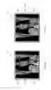 Fig. 04 - METHOD AND APPARATUS FOR GENERATING MEDICAL IMAGES