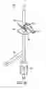 Fig. 48 - Medical fluid injection system