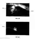 Fig. 07 - IMAGING METHODS AND COMPOSITIONS COMPRISING FLUORESCENT DYES ASSOCIATED WITH VIRAL COMPONENTS FOR NERVE IMAGING