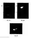 Fig. 08 - IMAGING METHODS AND COMPOSITIONS COMPRISING FLUORESCENT DYES ASSOCIATED WITH VIRAL COMPONENTS FOR NERVE IMAGING