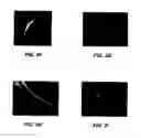 Fig. 11 - IMAGING METHODS AND COMPOSITIONS COMPRISING FLUORESCENT DYES ASSOCIATED WITH VIRAL COMPONENTS FOR NERVE IMAGING