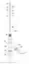 Fig. 01 - HIGH-FLOW TAPERED PERIPHERAL IV CATHETER WITH SIDE OUTLETS