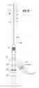 Fig. 06 - HIGH-FLOW TAPERED PERIPHERAL IV CATHETER WITH SIDE OUTLETS