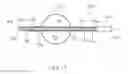 Fig. 16 - Apparatus and methods for treating obstructions within body lumens
