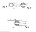 Fig. 03 - Apparatus and method for sensor deployment and fixation