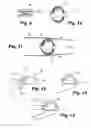 Fig. 04 - Apparatus and method for sensor deployment and fixation