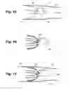Fig. 05 - Apparatus and method for sensor deployment and fixation
