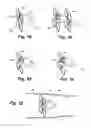 Fig. 06 - Apparatus and method for sensor deployment and fixation