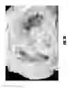 Fig. 02 - Method for determining the location of regions in tissue relevant to electrical propagation