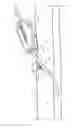 Fig. 02 - Systems and methods for anchoring medical devices