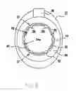 Fig. 06 - Subcutaneous Implantable Port and Method for Producing the Same