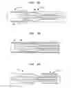 Fig. 07 - Tip for medical implant delivery system