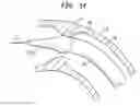 Fig. 08 - Tip for medical implant delivery system