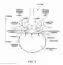 Fig. 02 - Mechanical tissue modification devices and methods
