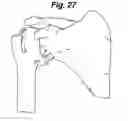 Fig. 09 - Shoulder arthroplasty instrumentation