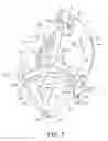 Fig. 02 - Patella resectioning guide and assembly