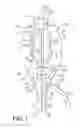 Fig. 06 - Patella resectioning guide and assembly