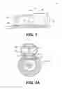 Fig. 02 - Endoluminal fundoplication device and related method