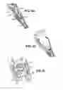 Fig. 11 - Apparatuses and methods for forming incisions in ocular tissue