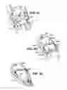 Fig. 12 - Apparatuses and methods for forming incisions in ocular tissue