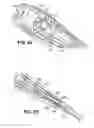 Fig. 16 - Apparatuses and methods for forming incisions in ocular tissue