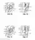 Fig. 19 - Apparatuses and methods for forming incisions in ocular tissue