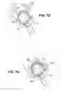 Fig. 20 - Apparatuses and methods for forming incisions in ocular tissue
