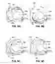 Fig. 22 - Apparatuses and methods for forming incisions in ocular tissue