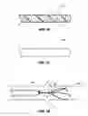 Fig. 08 - Endovascular filter and retrieval apparatus