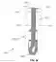 Fig. 41 - KNOTLESS SUTURE ANCHOR FOR SECURING SOFT TISSUE TO BONE