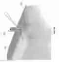 Fig. 53 - KNOTLESS SUTURE ANCHOR FOR SECURING SOFT TISSUE TO BONE