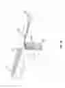 Fig. 56 - KNOTLESS SUTURE ANCHOR FOR SECURING SOFT TISSUE TO BONE