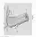 Fig. 66 - KNOTLESS SUTURE ANCHOR FOR SECURING SOFT TISSUE TO BONE