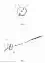 Fig. 02 - Surgical retracting device and method for the manufacture thereof