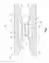 Fig. 02 - Compliant implant