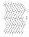 Fig. 03 - Stent with support braces