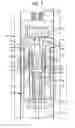 Fig. 05 - Staged deployment devices and methods for transcatheter heart valve delivery systems