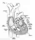 Fig. 02 - Prosthetic heart valve frame with flexible commissures